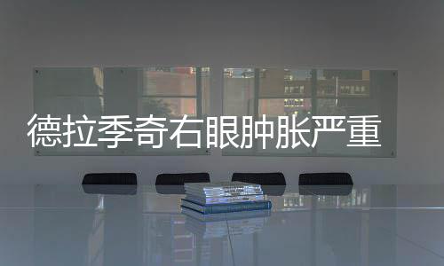 中国首部“暗黑治愈系”电影《谋杀安徒生之海的女儿》开机 肿胀主帅肿起来的热火右眼